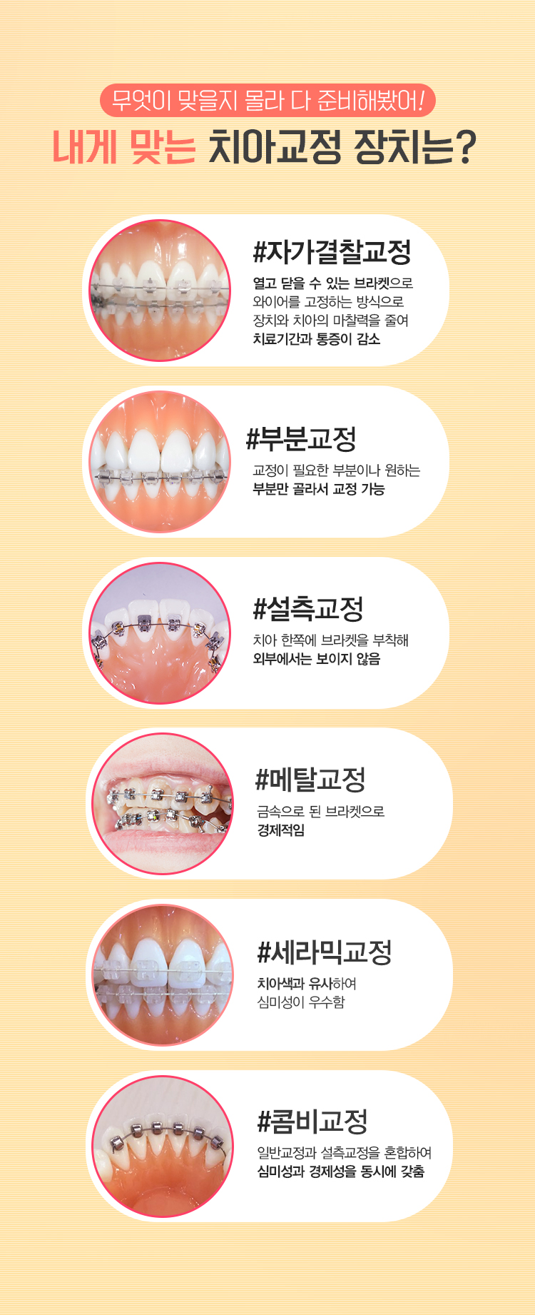 안양치과연세바른